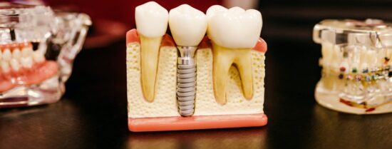 Top 8 Dental Implant Web Designs